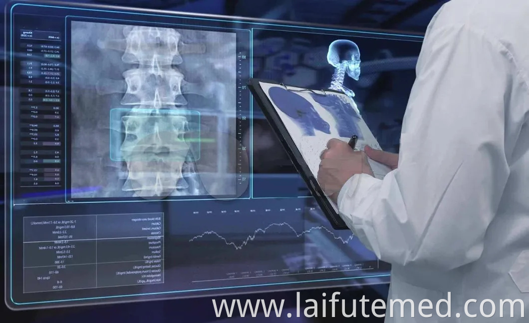 Advanced Veterinary Pet X Ray Machine for Diagnostic Imaging Needs